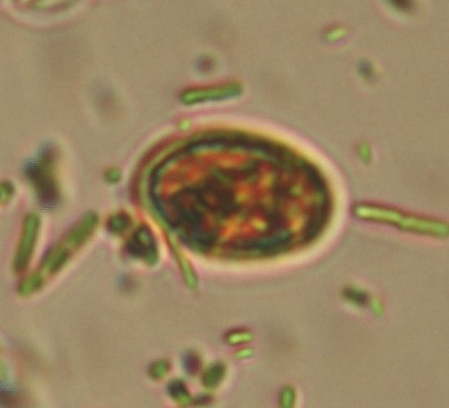 Detalle Quiste de Giardia duodenalis